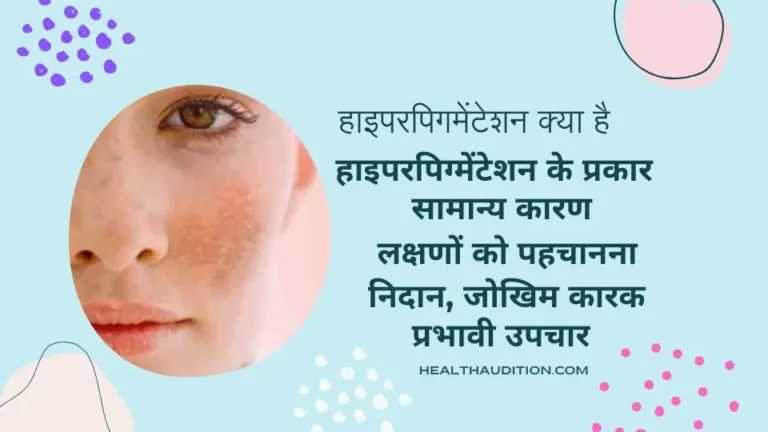 Hyperpigmentation: जाने क्यों होता है हाइपरपिग्मेंटेशन ,कैसे छुटकारा पा सकते हैं ?