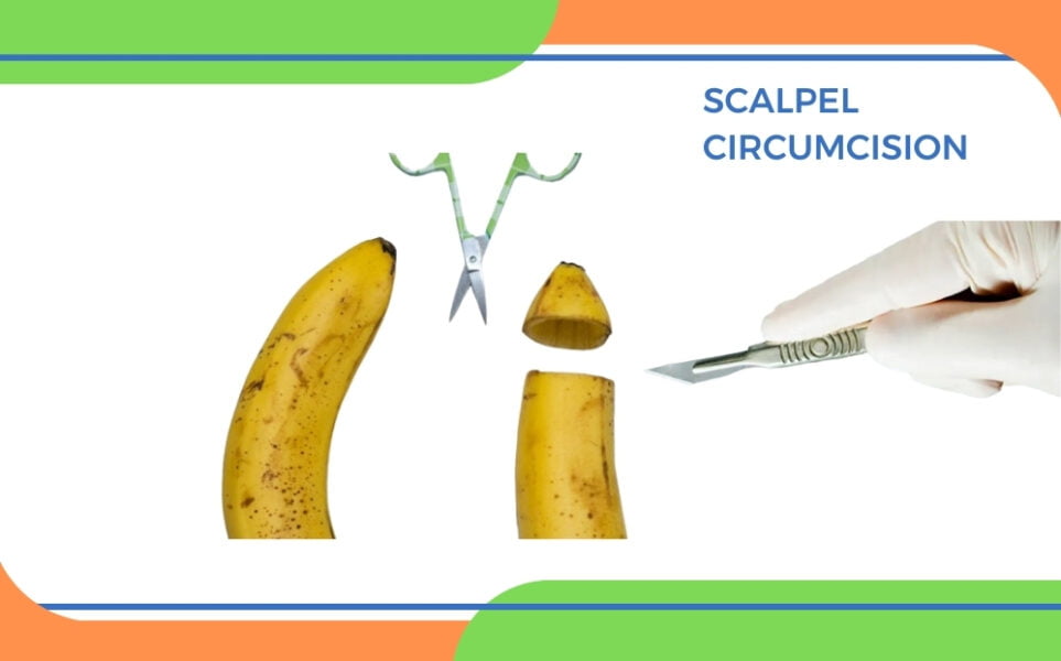 Scalpel circumcision