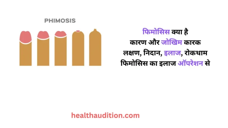 फाइमोसिस: लिंग की त्वचा से जुड़ी समस्या है फाइमोसिस, जानें इससे बचें कैसे ज्यादातर पुरुष इस समस्या को बताने से शर्माते हैं