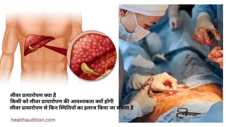 liver transplant surgery: मृत्यु से जिंदगी की ओर एक कदम ।