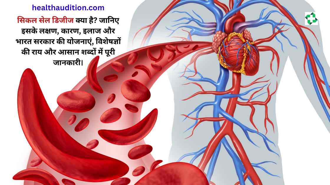 Sickle Cell Disease in Hindi